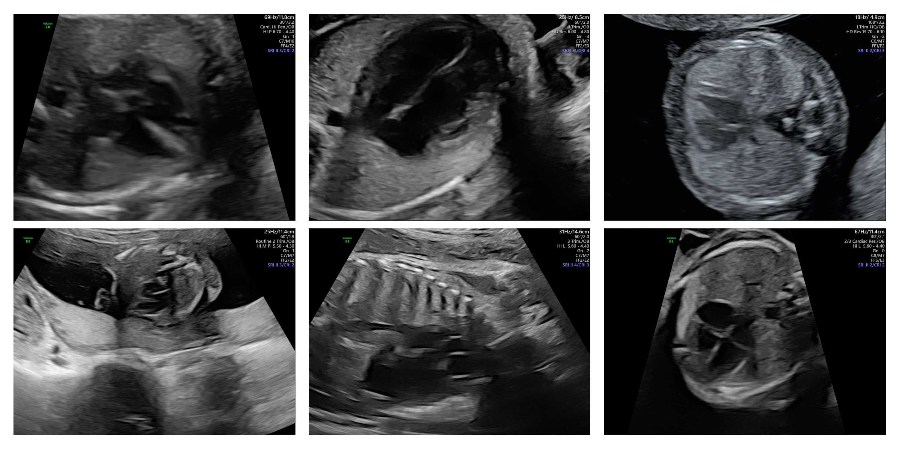 CARDIUM Dataset Statistics